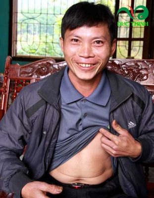 hình ảnh anh Hòa khỏi bệnh ung thư gan