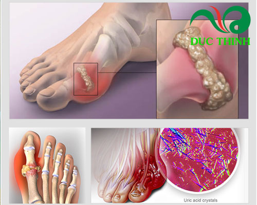 Cách phân biệt cây tơm Trơng thật và giả