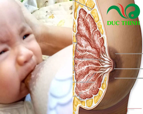 Cây bồ công anh trị sưng vú