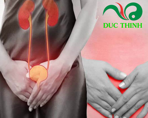 Cầy bồ công anh điều trị viêm đường tiết niệu