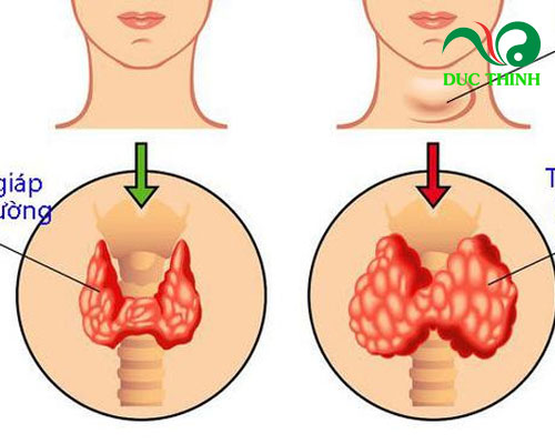 tac_dung_cua_cay_soi_rung