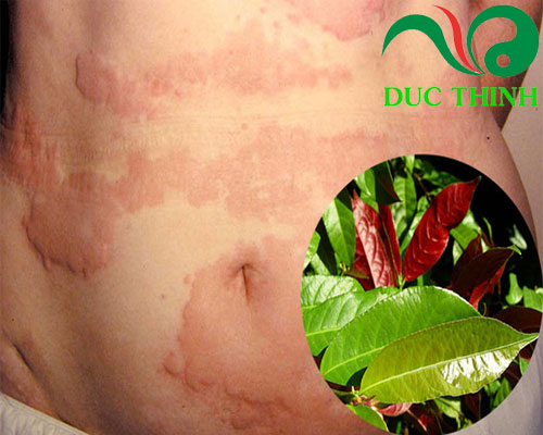 cay_don_la_do_tri_benh_me_day