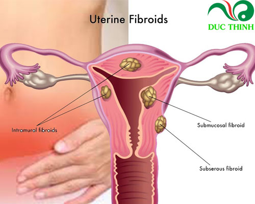 Tác dụng của cây bạch hoa xà thiệt thảo