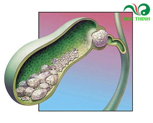 Diệp hạ châu chữa bệnh gì