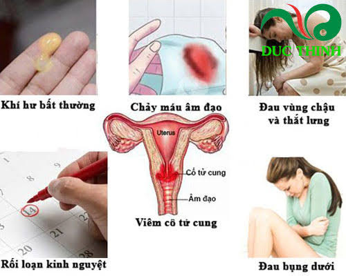 cong_dung_cay_bach_dong_nu