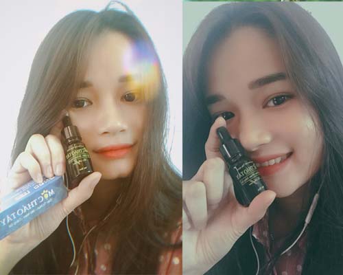 khách hàng đã sử dụng mộc thảo tây trị mụn