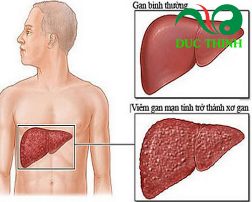 Kim ngân hoa chữa bệnh gì