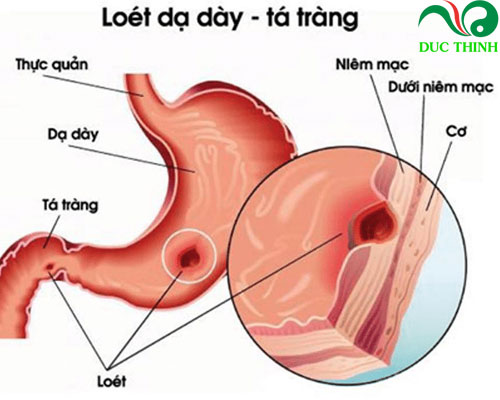 Cách sử dụng chè dây Sapa