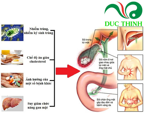 nguyen_nhan_hinh_thanh_soi_mat