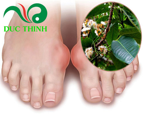 nu_voi_ho_tro_dieu_tri_gout