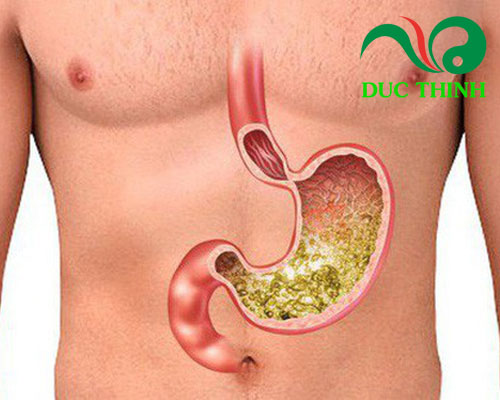 Tinh bột nghệ đen chữa đau dạ dày