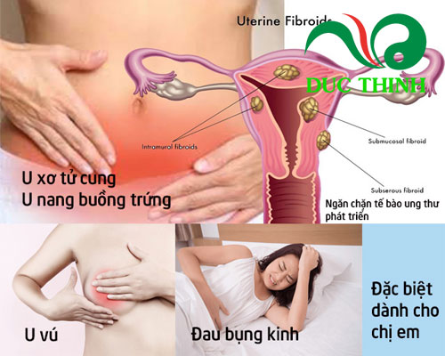cây trinh nữ hoàng cung
