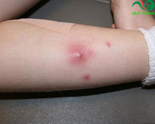 Tác dụng của cây bạch hoa xà thiệt thảo