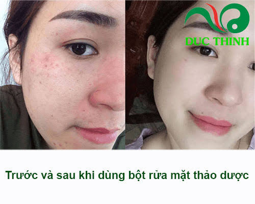 tac_dung_bot_rua_mat_thao_duoc