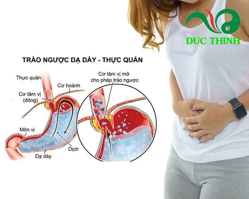 Trào Ngược Dạ Dày Có Nguy Hiểm Không?