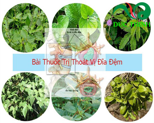 Bài thuốc chữa thoát vị đĩa đệm từ cây chìa vôi
