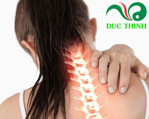 Cây xương khỉ chữa thoái hóa cột sống