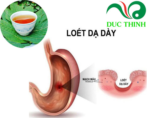 la_du_du_duc_tri_viem_loet_da_day