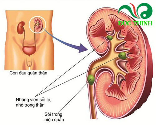 Công dụng của diệp dạ châu