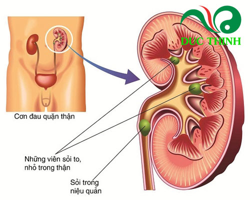 Cây râu mèo trị bệnh gì?