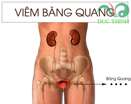 Cây râu mèo trị bệnh gì?