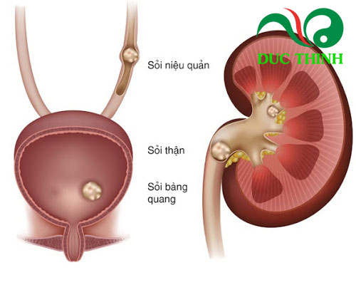Cây râu mèo trị bệnh gì?