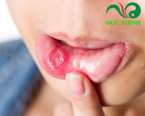 Tác dụng của bạch tật lê ngâm rượu