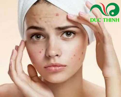 Tác dụng của cây râu mèo