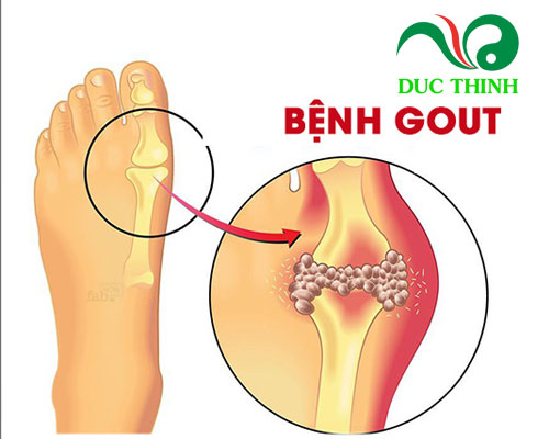 Quả dứa dại ngâm rượu có tác dụng gì?