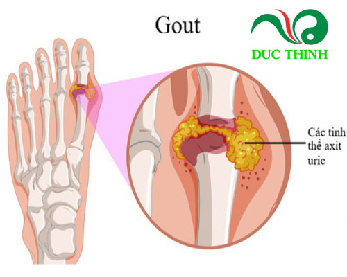 Tác dụng của củ ráy