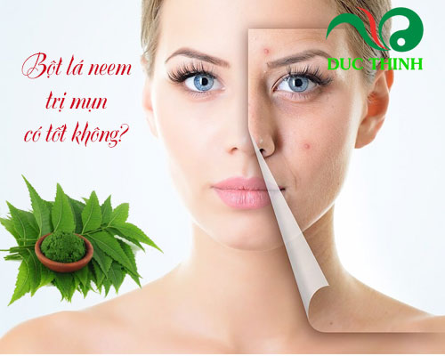 Bột lá neem trị mụn có tốt không?