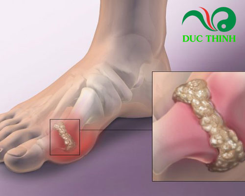 Công dụng của viên cao gắm