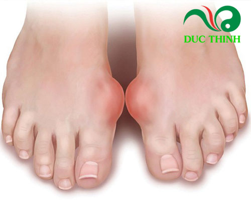 Tác dụng của lá vối là gì?