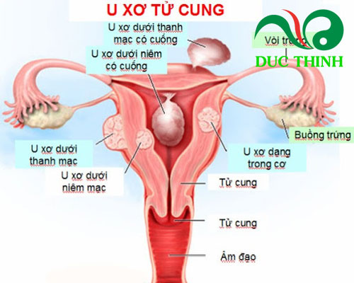 Trà trinh nữ hoàng cung có tác dụng gì?