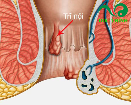 Vì sao nhiều người tìm mua hoa kim châm?