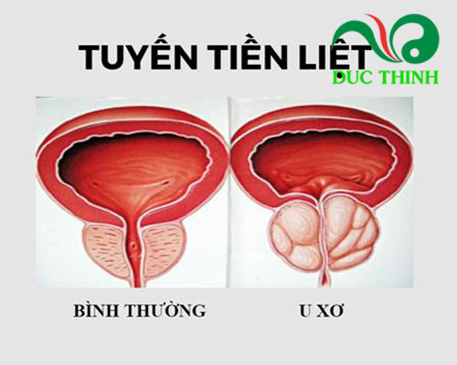 Cách sử dụng cây náng hoa trắng