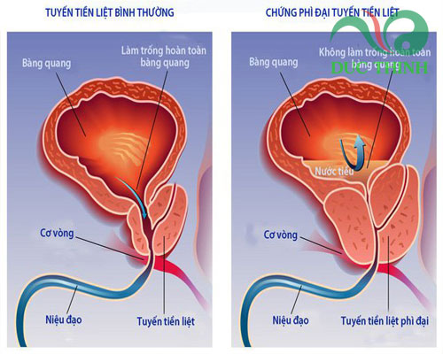 Cây náng hoa trắng có tác dụng gì?