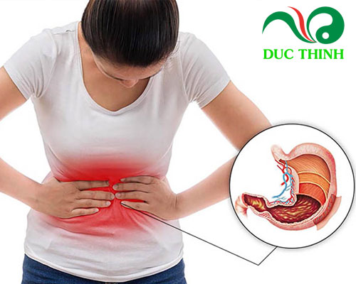 Hoa hồi ngâm rượu có tác dụng gì?