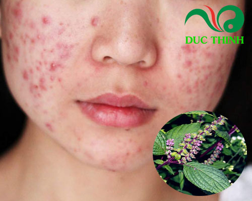 Hương nhu có tác dụng gì?