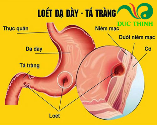 Lá khôi tía có tác dụng gì?