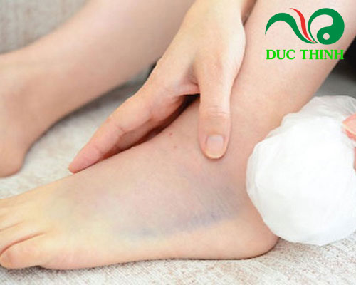 Cây náng hoa trắng có tác dụng gì?