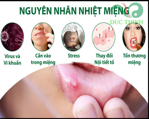 Nguyên nhân gây ra nhiệt miệng