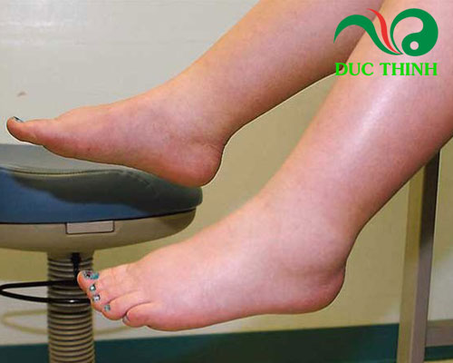 Rễ dâu tằm có tác dụng gì?