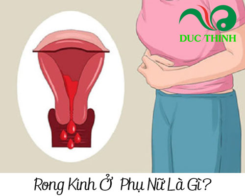 Rong kinh ở phụ nữ là gì?